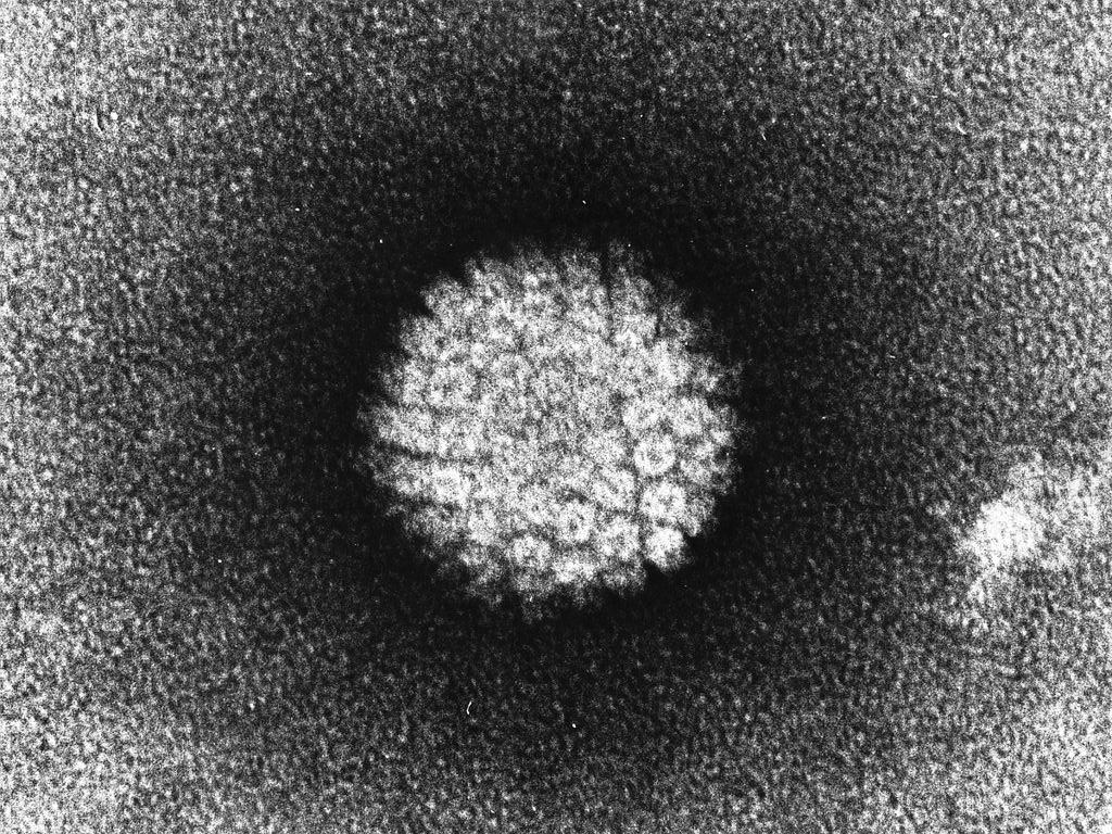 45. papillomavírus vírus papilloma vs papilloma