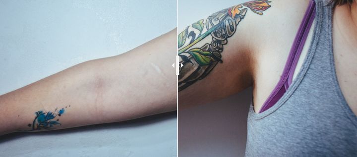 татуировка на шраме